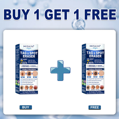 ⏰ Exclusive HISKIN® Deal Unlocked! Save an Extra 90% Today Only – Claim It Before This Offer Expires!