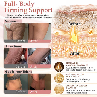 HISKIN® BREAST ENHANCEMENT  LIFT & FIRM MICRONEEDLE PATCHES